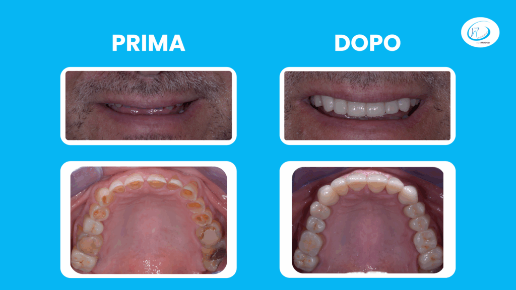 Prima e dopo il trattamento